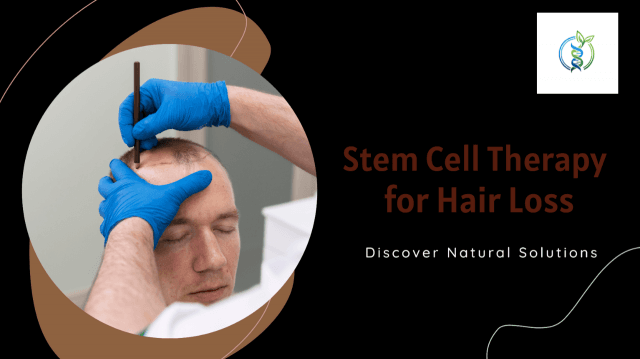 Stem Cell Therapy for Hair Loss